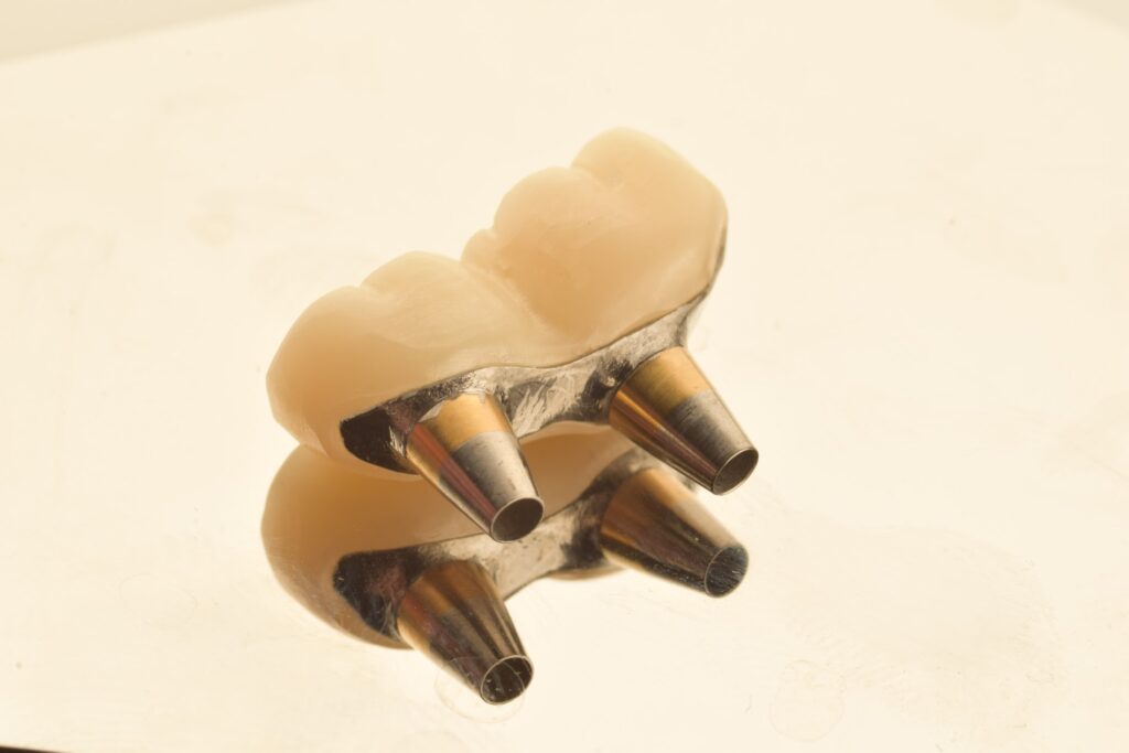Dental Implants
